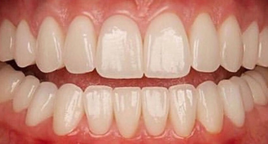 Burke Dental | CBCT, Laser Dentistry and Full Mouth Reconstruction