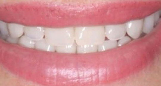 Burke Dental | CBCT, Pediatric Dentistry and Dentures