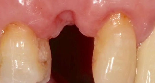 Burke Dental | Emergency Treatment, Oral Exams and Root Canals