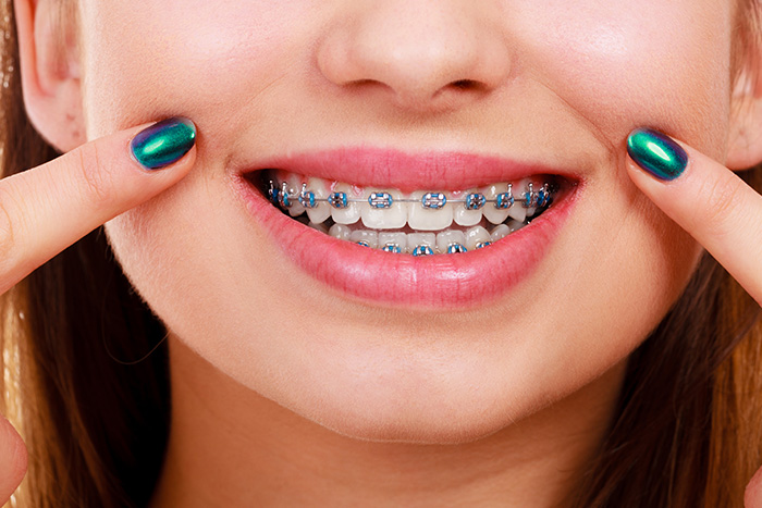 Burke Dental | CEREC, Root Canals and TMJ Disorders