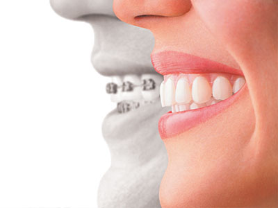 The image is a digitally altered photograph that shows two halves of a smiling face, with one side representing a person's natural teeth and the other showing a dental implant or prosthetic.