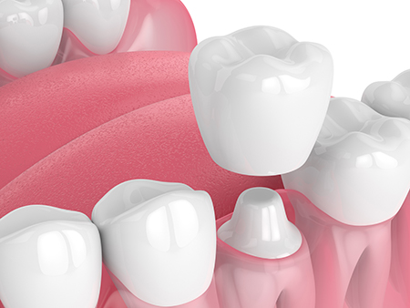 Burke Dental