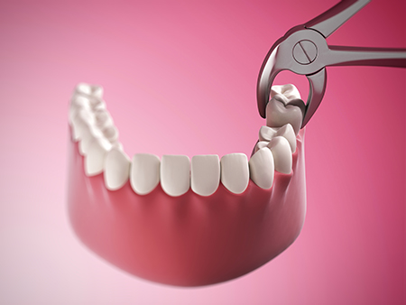 Burke Dental