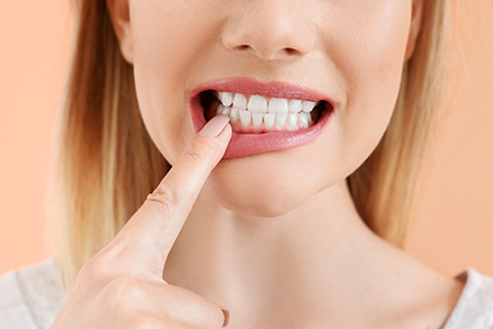Burke Dental